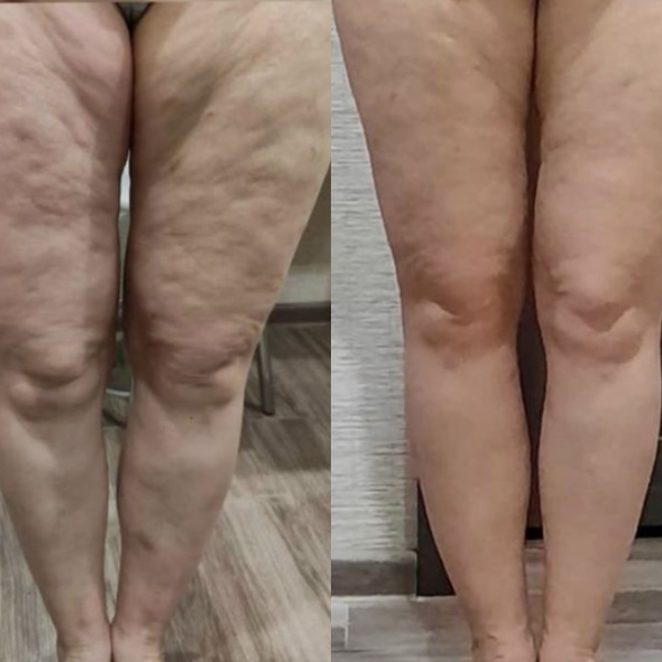 Customer result