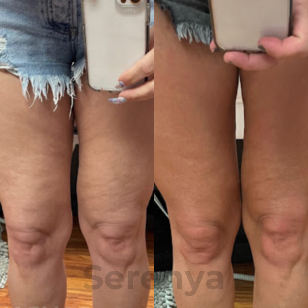Customer result